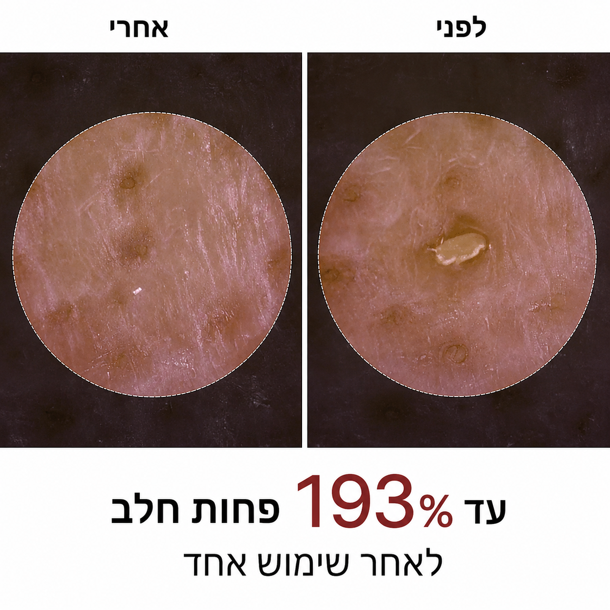 Patchiv™ גולד פיל שוט